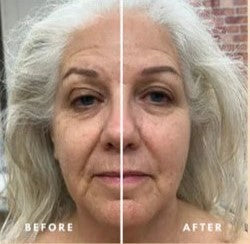 Aurevia™ Lymphatic Face Brush